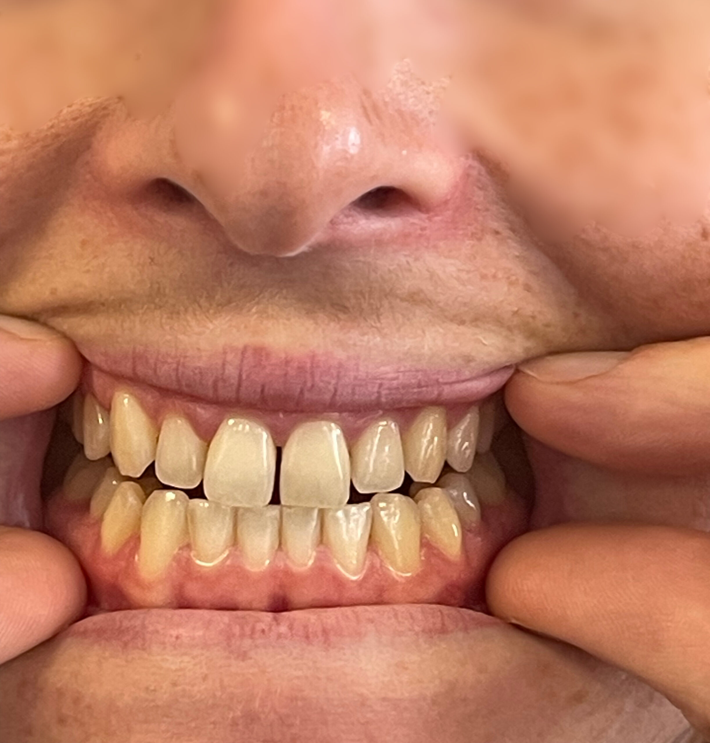 Formation Orthodontie fonctionnelle et ostéopathie : regards croisés