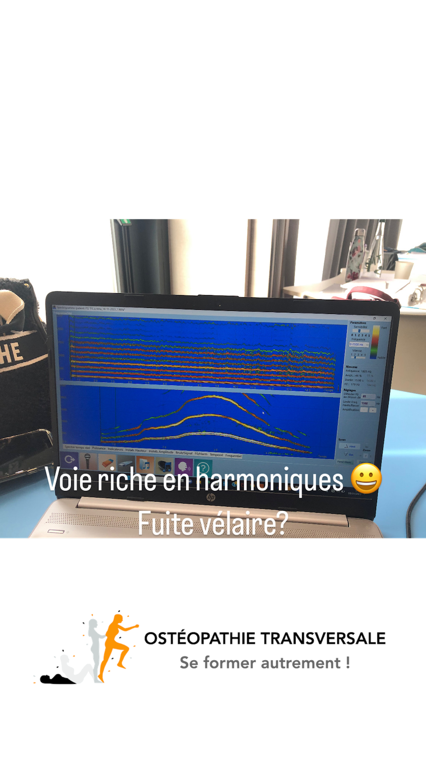 Formation pour orthophonistes en oromyo à Toulouse - fuite vélaire Formation pour orthophonistes en oromyo à Toulouse - fuite vélaire